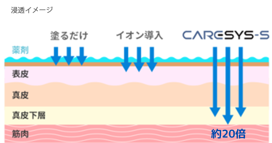 CARESYS-S（ケアシス）
