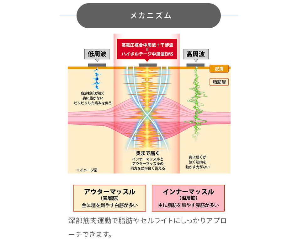 STAR tech（スターテック）